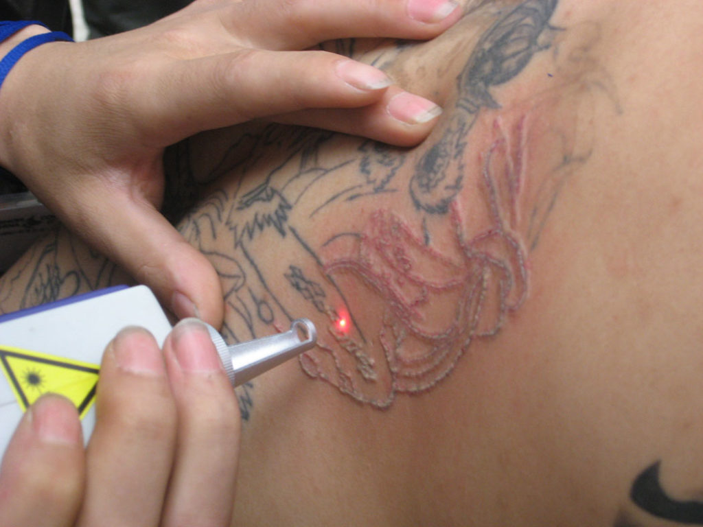 Вред татуировок для здоровья, интересные факты